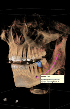Integrated implantology